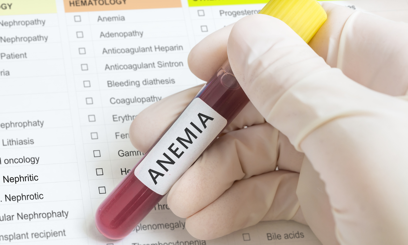 As causas da anemia em vegetarianos anemia em vegetarianos
